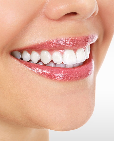 Closeup of smile after esthetic gingival recontouring