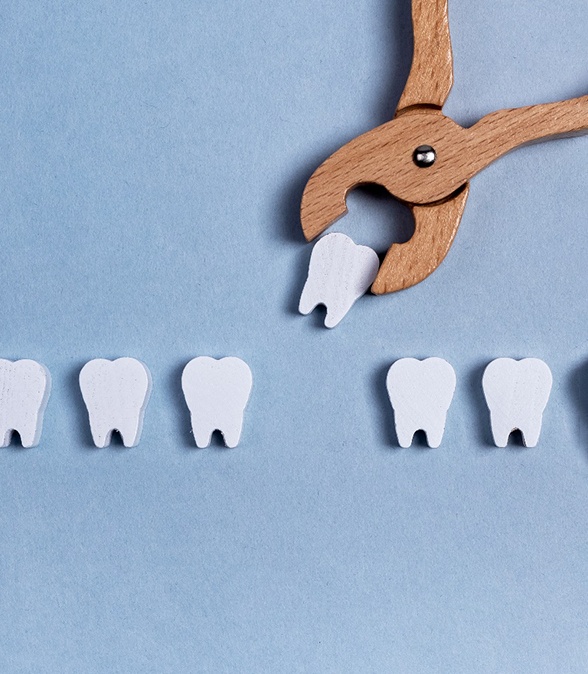 Illustration of tooth extraction