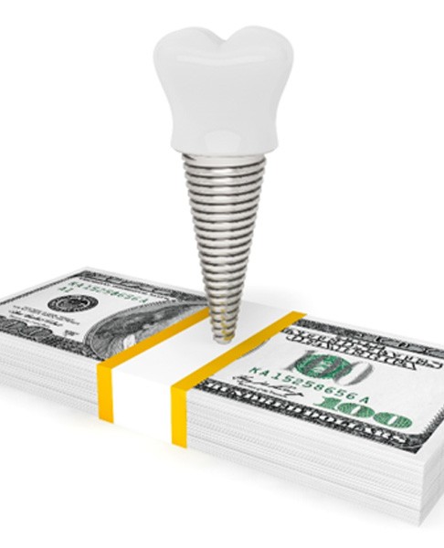 Dental implant on a pile of money