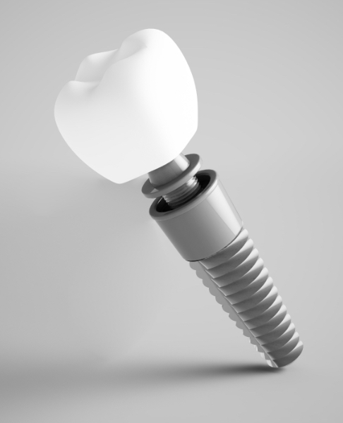 Animated parts of a dental implant supported replacement tooth