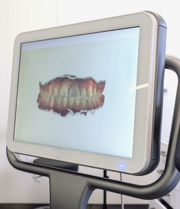 Digital image of teeth on computer screen