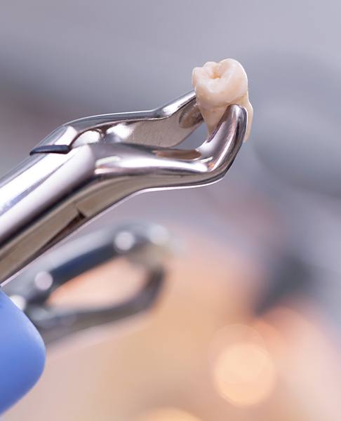 Metal clasp holding extracted tooth