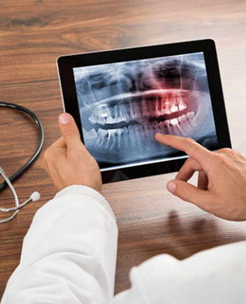 Periodontist in Dallas holding a tablet showing an X-ray
