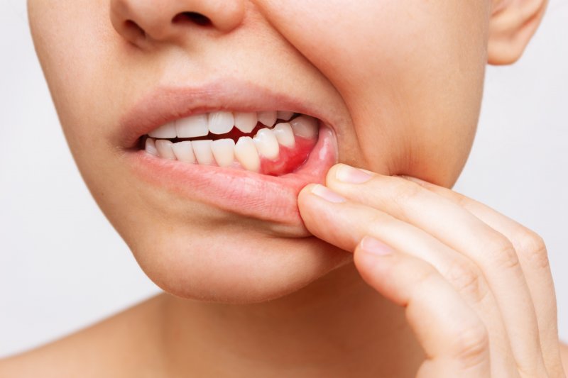 A patient hoping to avoid gum disease